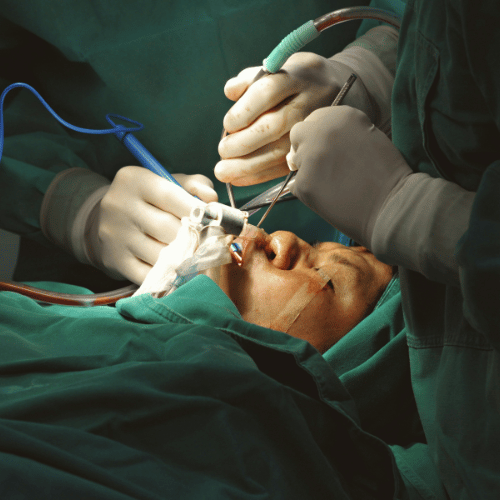 Chirurgie esthétique : Révolutions sociétales et technologiques