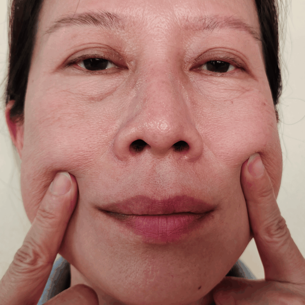 Lifting visage : le secret d’un résultat naturel