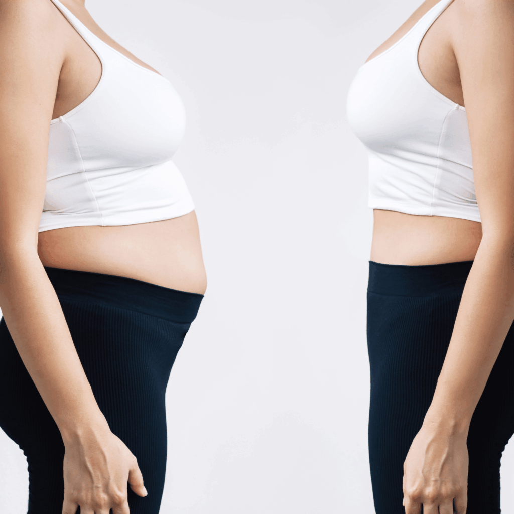 Après grossesse : quelles solutions pour retrouver son corps ?