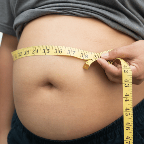 Liposuccion du ventre : résultats et limites de l’intervention