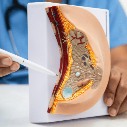Mastopexie (lifting des seins) : remonter la poitrine sans augmenter le volume