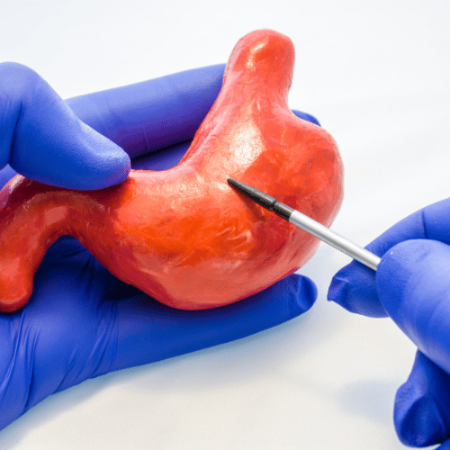 Otoplastie : corriger les oreilles décollées efficacement